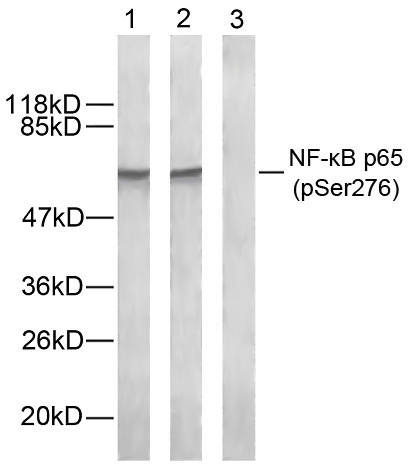 NFκB-p65(Phospho-Ser276) Antibody - Absci