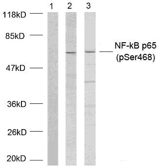 NFκB-p65(Phospho-Ser468) Antibody - Absci