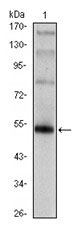 FOXP3 Monoclonal Antibody - Absci