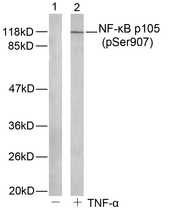 NFκB-p105(Phospho-Ser907) Antibody - Absci