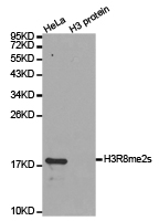 Histone H3R8me2s Polyclonal Antibody - Absci