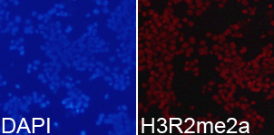 Histone H3R2me2a Polyclonal Antibody - Absci