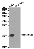 Histone H4R3me2s Polyclonal Antibody - Absci