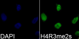 Histone H4R3me2s Polyclonal Antibody - Absci