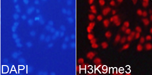 Histone H3K9me3 Polyclonal Antibody - Absci