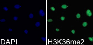 Histone H3K36me2 Polyclonal Antibody - Absci