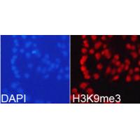 Histone H3K9me3 Polyclonal Antibody