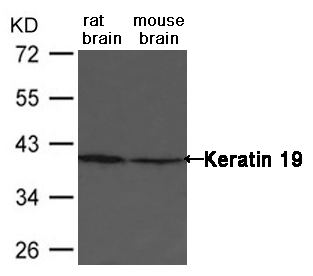 Keratin 19 Antibody - Absci