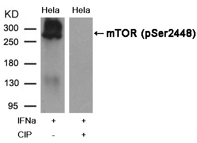 mTOR(Phospho-Ser2448) Antibody - Absci