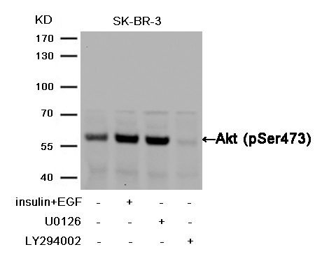 Akt(Phospho-Ser473) Antibody - Absci