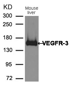 VEGFR3 Antibody - Absci
