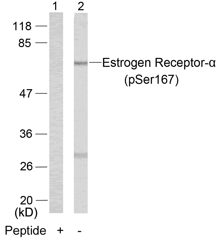 Estrogen Receptor-a(Phospho-Ser167) Antibody - Absci