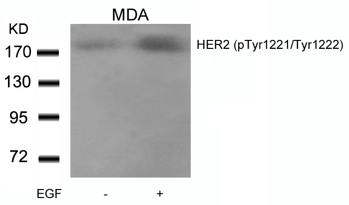 HER2(Phospho-Tyr1221/Tyr1222) Antibody - Absci