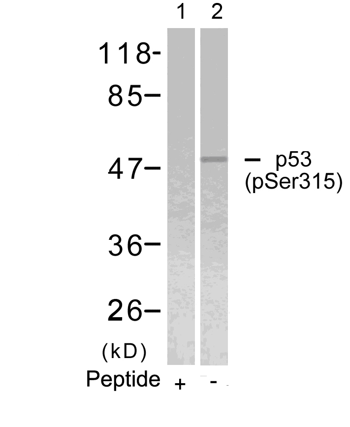 p53(Phospho-Ser315) Antibody - Absci