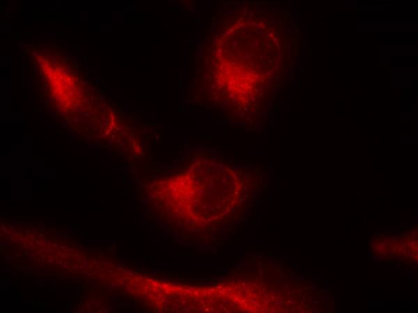 Tau(Phospho-Ser356) Antibody - Absci