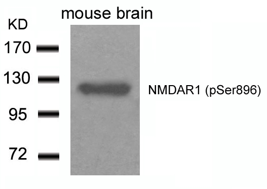 NMDAR1(Phospho-Ser896) Antibody - Absci