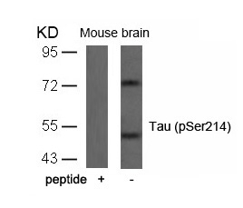 Tau(Phospho-Ser214) Antibody - Absci