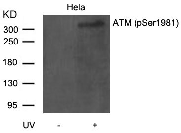 ATM(Phospho-Ser1981) Antibody - Absci