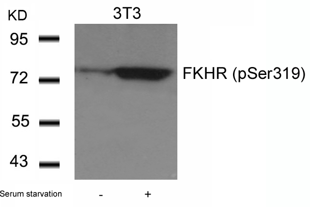 FKHR(Phospho-Ser319) Antibody - Absci