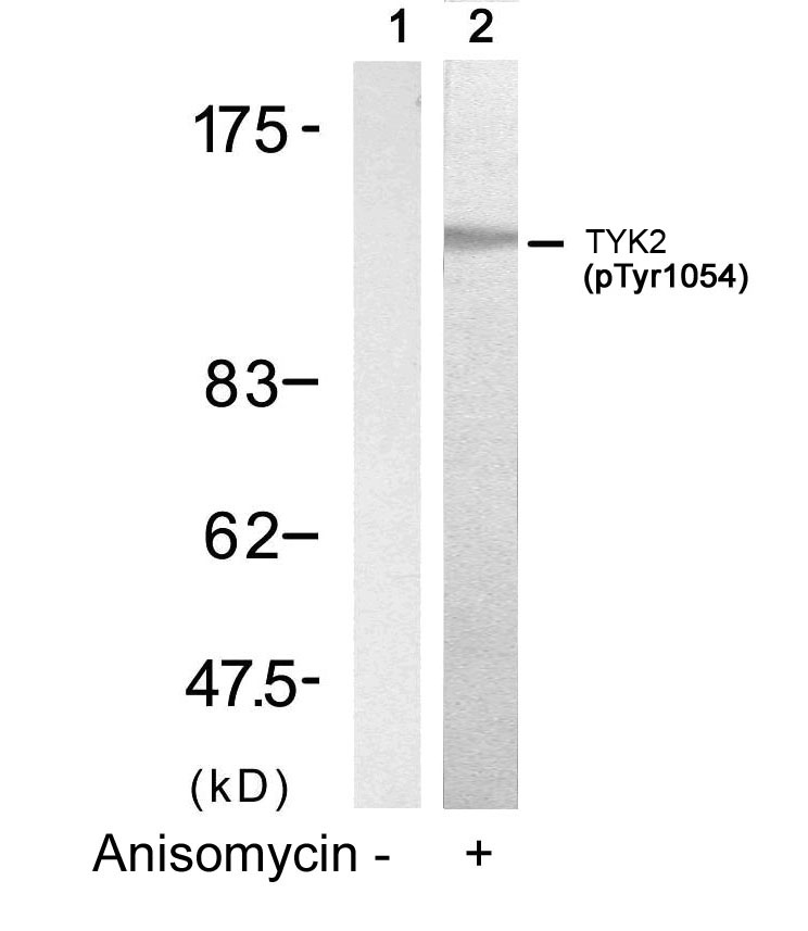 TYK2(Phospho-Tyr1054) Antibody - Absci