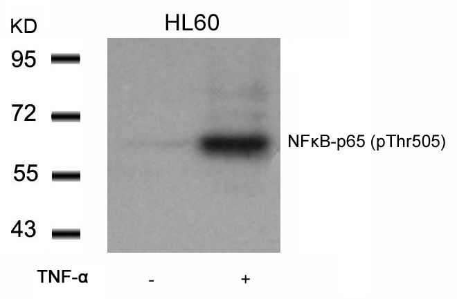 NFkB-p65(Phospho-Thr505) Antibody - Absci