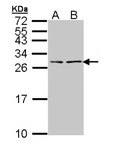 BNP antibody - Absci