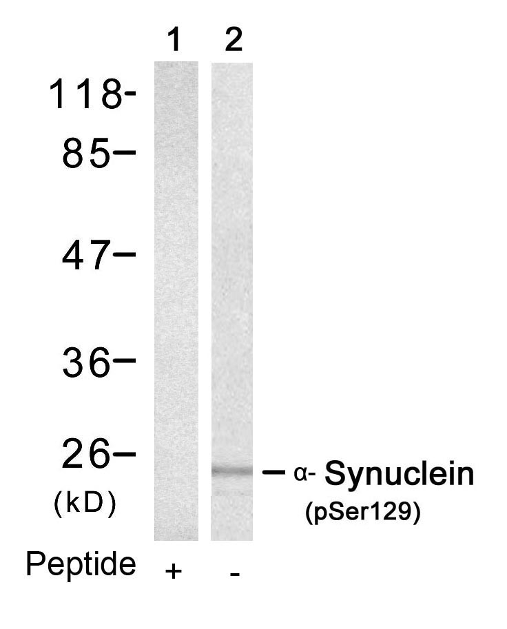a-Synuclein(Phospho-Ser129) Antibody - Absci