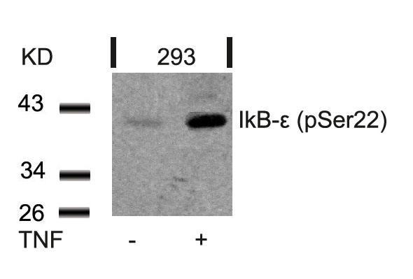 IkB-e(Phospho-Ser22) Antibody - Absci