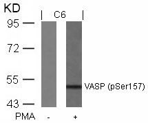VASP(Phospho-Ser157) Antibody - Absci