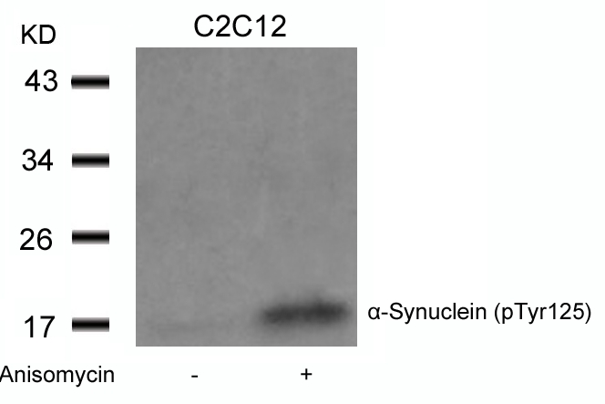 a-Synuclein(Phospho-Tyr125) Antibody - Absci