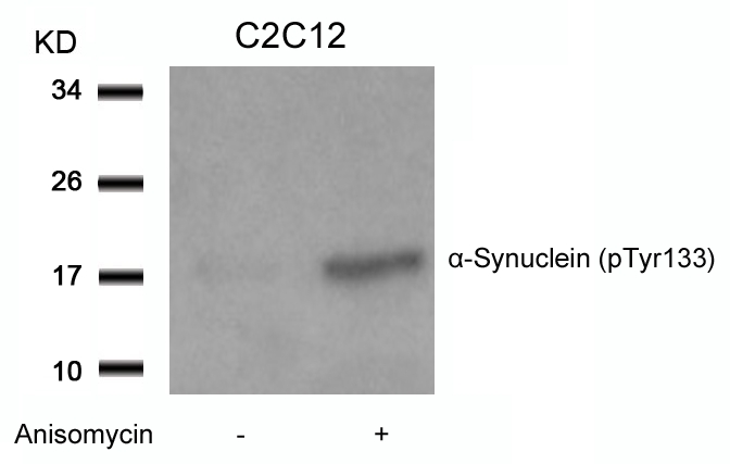 a-Synuclein(Phospho-Tyr133) Antibody - Absci