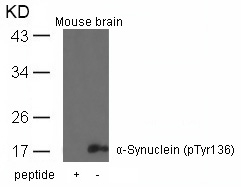 a-Synuclein(Phospho-Tyr136) Antibody - Absci