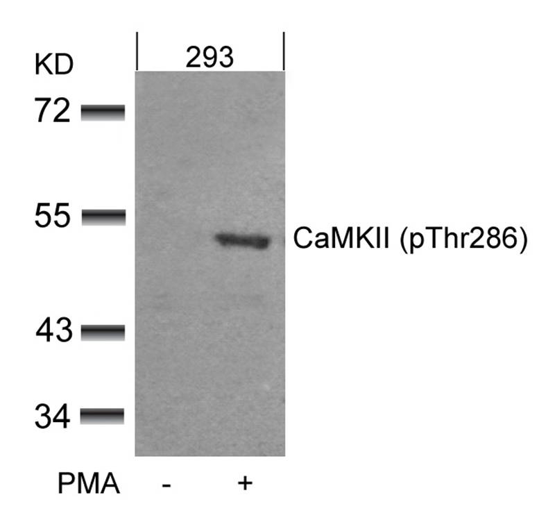 CaMKII(Phospho-Thr286) Antibody - Absci