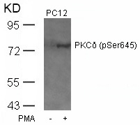 PKCd(Phospho-Ser645) Antibody - Absci