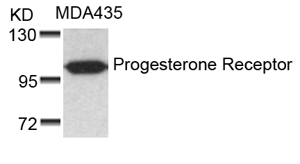 Progesterone Receptor(Ab-190) Antibody - Absci