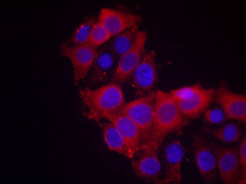 VEGFR2(Ab-1214) Antibody - Absci
