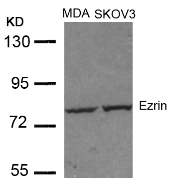 Ezrin(Ab-353) Antibody - Absci
