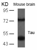 Tau(Ab-235) Antibody - Absci