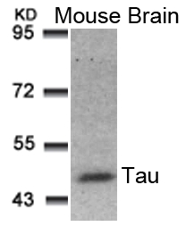 Tau(Ab-181) Antibody - Absci