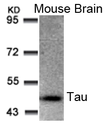 Tau(Ab-205) Antibody - Absci