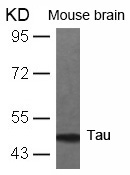 Tau(Ab-231) Antibody - Absci