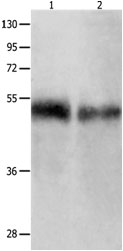 BPIFB1 Antibody - Absci