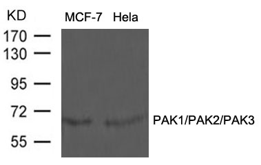PAK1/PAK2/PAK3(Ab-423/402/421) Antibody - Absci
