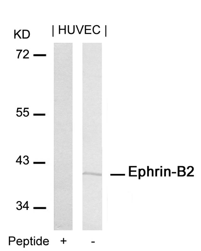 Ephrin-B2(Ab-316) Antibody - Absci