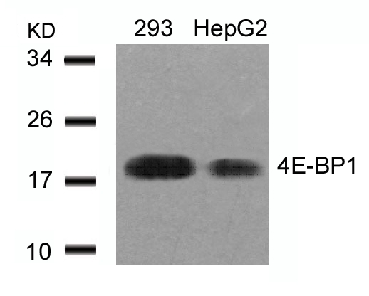 4E-BP1(Ab-46) Antibody - Absci