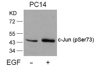 c-Jun(Phospho-Ser73) Antibody - Absci