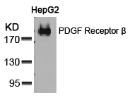 PDGF Receptor b(Ab-751) Antibody - Absci