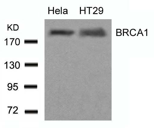BRCA1(Ab-1423) Antibody - Absci