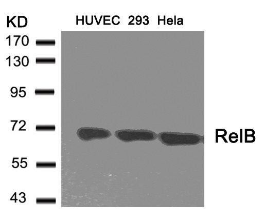 RelB(Ab-573) Antibody - Absci