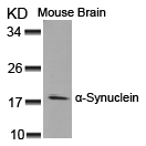 a-Synuclein(Ab-125) Antibody - Absci